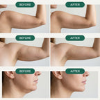 Serenzza Lymphatic Drainage Drops supplement bottle with dropper, designed to reduce bloating and support immunity.
