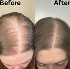 Serenza Tgideas Rosemary Shampoo before and after comparison showing improved hair health and shine.