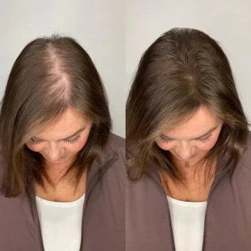 Serenzza Tgideas Rosemary Shampoo bottle, showing before and after hair treatment results with healthy, shiny hair.