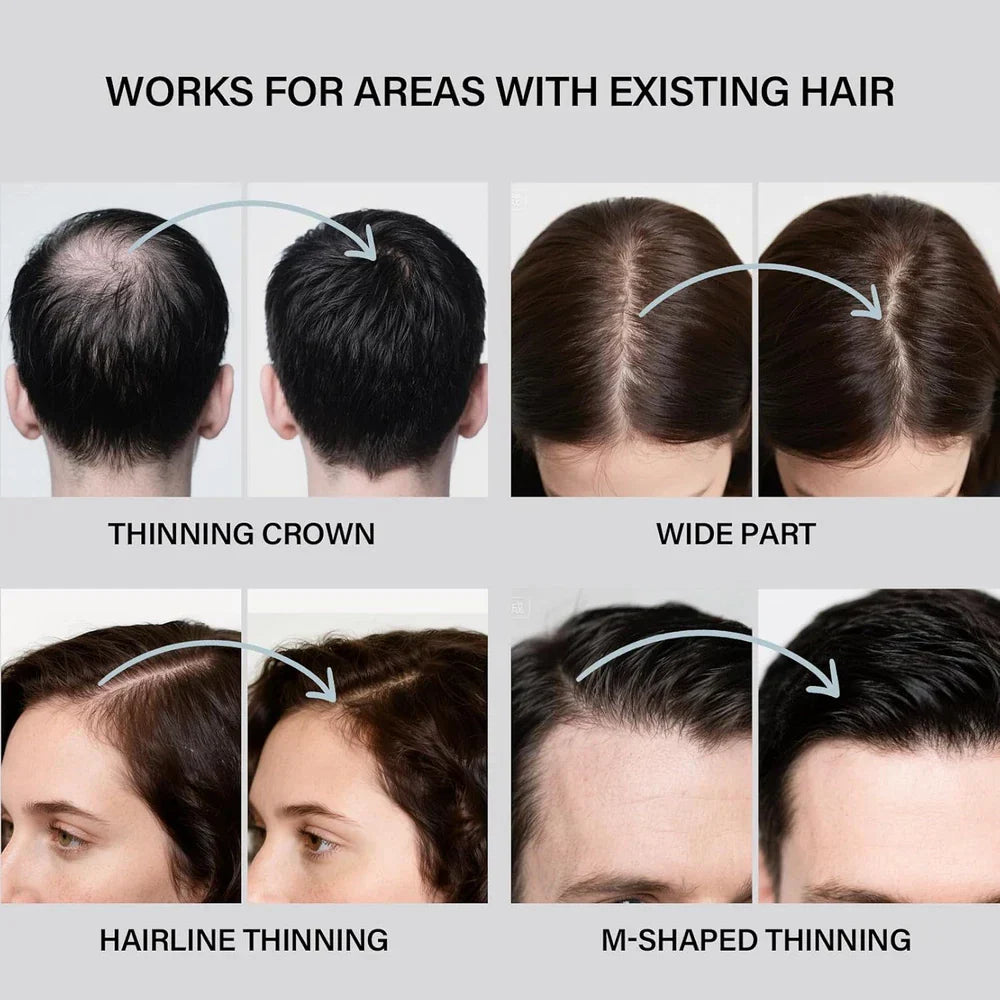 Serenzza Hair Building Fibers 2-in-1 kit for men and women, showing fibers applied to thinning hair for fuller look