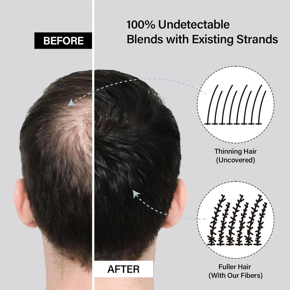 Serenzza Hair Building Fibers 2-in-1 kit for men and women, showing fibers in a container with hair strands for thinning hair.