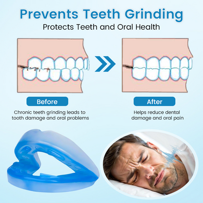Serenzza anti-snoring and teeth grinding protector for oral health, shown in a close-up of the mouth.